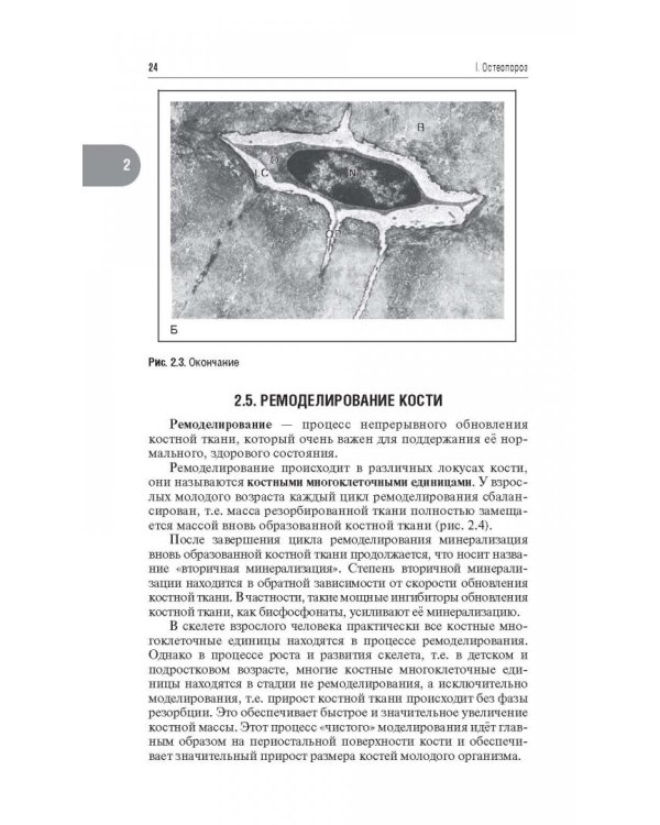 Остеопороз, гиперпаратиреоз и дефицит витамина D