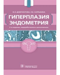 Гиперплазия эндометрия