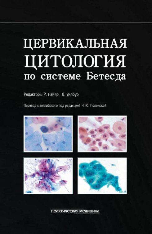 Обложка книги «Цервикальная цитология по системе Бетесда. Терминология, критерии и пояснения» — Наяйр Риту, Уилбур Дэвид, Сибас Эдмунд, ISBN 9785988114611