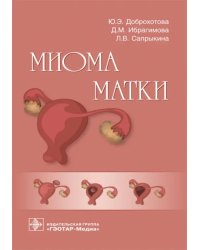Миома матки. Руководство