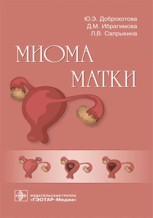 Миома матки. Руководство Миома матки. Руководство