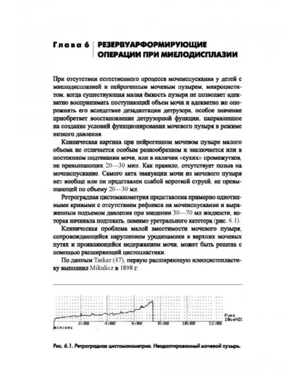 Синдром миелодисплазии у детей (клиника, диагностика, лечение)