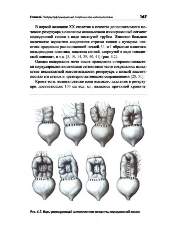 Синдром миелодисплазии у детей (клиника, диагностика, лечение)