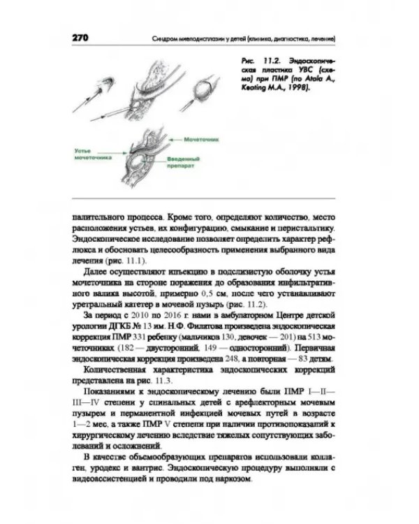 Синдром миелодисплазии у детей (клиника, диагностика, лечение)