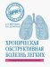 Хроническая обструктивная болезнь легких (ХОБЛ). Руководство для практических врачей