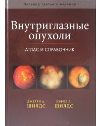 Внутриглазные опухоли. Атлас и справочник