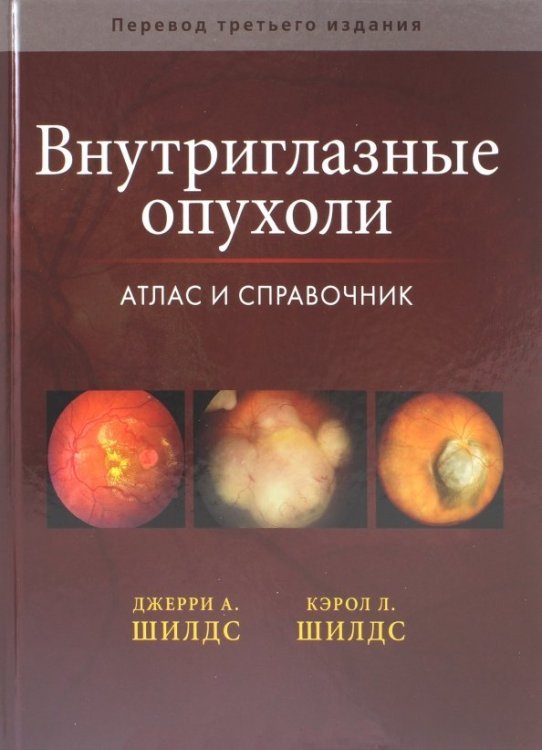 Внутриглазные опухоли. Атлас и справочник