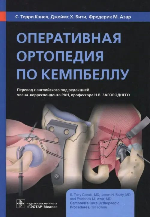 Оперативная ортопедия по Кемпбеллу. Руководство Оперативная ортопедия по Кемпбеллу. Руководство