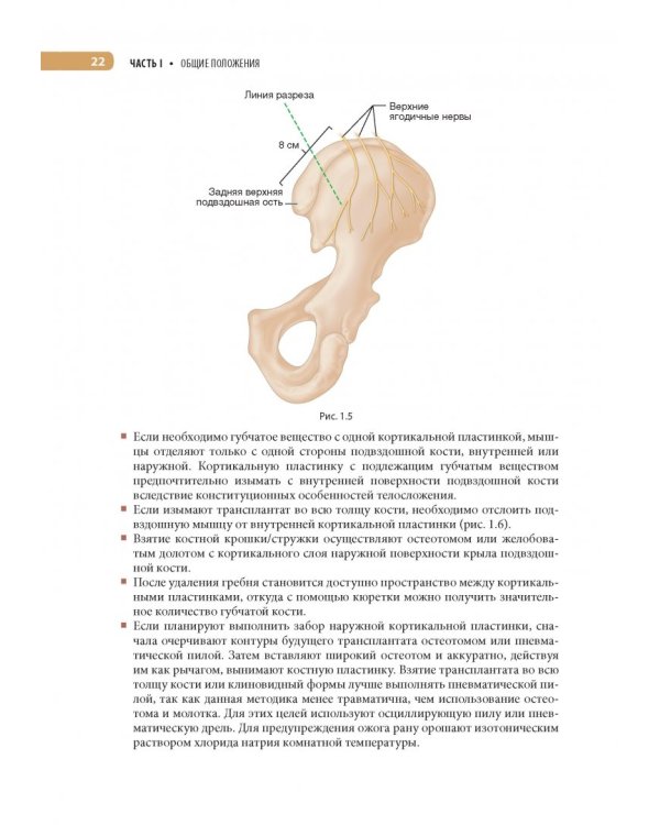 Оперативная ортопедия по Кемпбеллу. Руководство