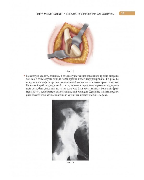 Оперативная ортопедия по Кемпбеллу. Руководство