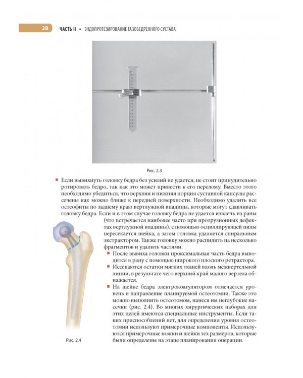 Оперативная ортопедия по Кемпбеллу. Руководство