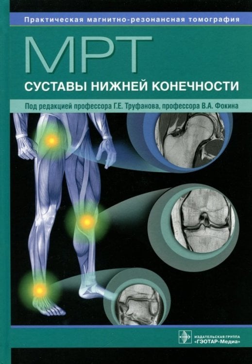 МРТ. Суставы нижней конечности. Руководство для врачей