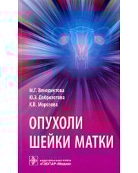 Опухоли шейки матки