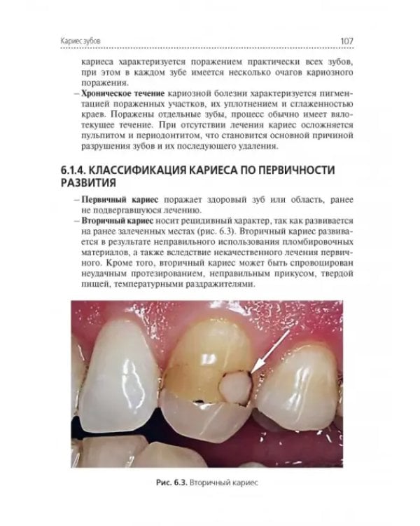 Дополнительное изображение книги «Стоматологические заболевания. Учебник»