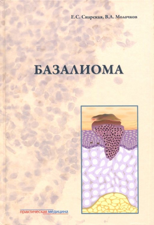 Обложка книги «Базалиома» — Молочков Владимир Алексеевич, Снарская Елена Сергеевна, ISBN 9785988114512