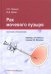 Рак мочевого пузыря. Краткий справочник