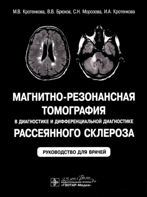 Магнитно-резонансная томография в диагностике и дифференциальной диагностике рассеянного склероза. Руководство для врачей