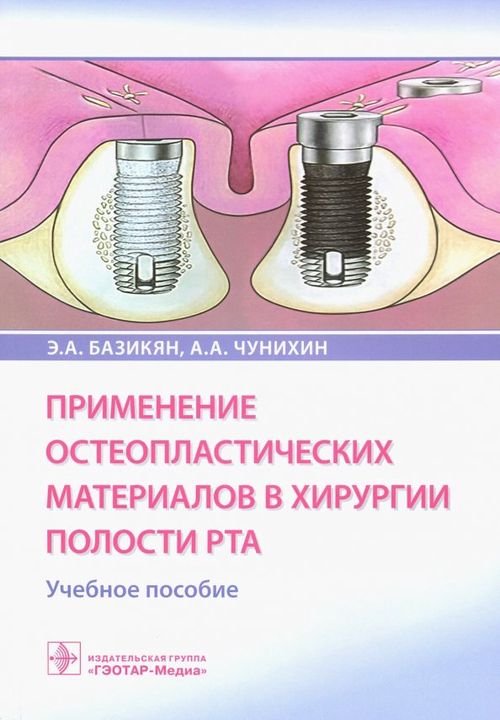 Применение остеопластических материалов в хирургии полости рта