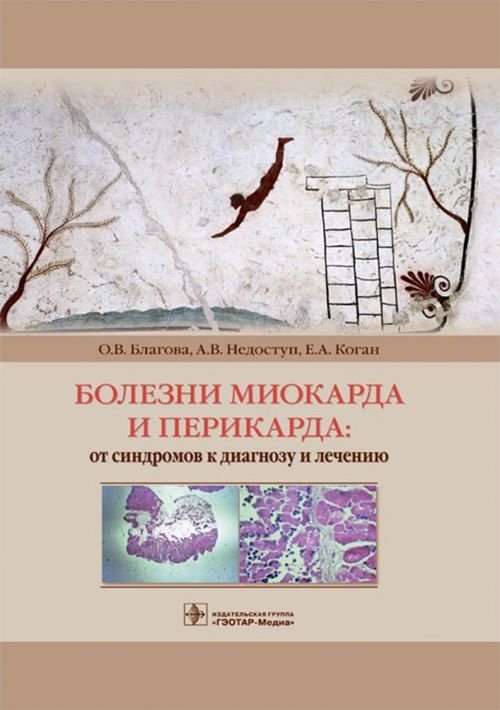 Болезни миокарда и перикарда. От синдромов к диагнозу и лечению Болезни миокарда и перикарда. От синдромов к диагнозу и лечению