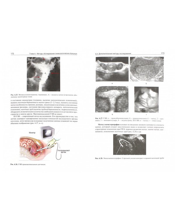 Гинекология. Учебник