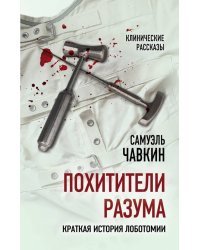 Похитители разума. Краткая история лоботомии