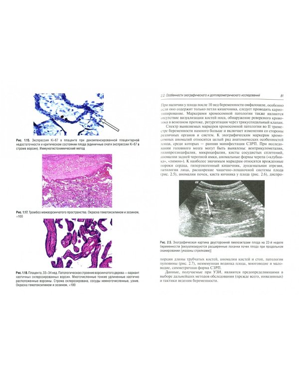 Критическое состояние плода. Диагностические критерии, акушерская тактика, перинатальные исходы