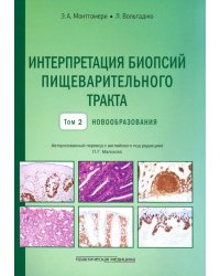 Интерпретация биопсий пищеварительного тракта. Том 2. Новообразования