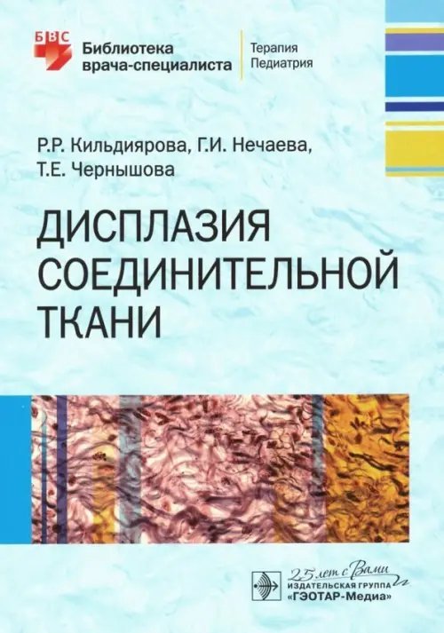 Библиотека врача-специалиста Дисплазия соединительной ткани