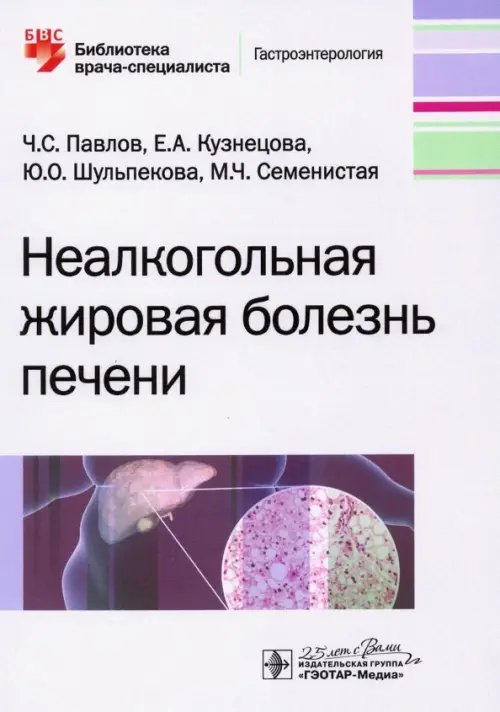 Неалкогольная жировая болезнь печени