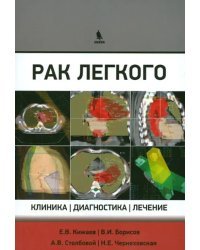 Рак легкого. Клиника, диагностика, лечение