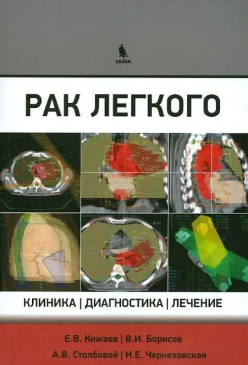 Обложка книги «Рак легкого. Клиника, диагностика, лечение» — Чернеховская Наталья Евгеньевна, Кижаев Евгений Васильевич, Столбовой Александр Викторович, Борисов Василий Иванович, ISBN 9785951805911