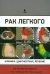Обложка книги «Рак легкого. Клиника, диагностика, лечение» — Чернеховская Наталья Евгеньевна, Кижаев Евгений Васильевич, Столбовой Александр Викторович, Борисов Василий Иванович, ISBN 9785951805911