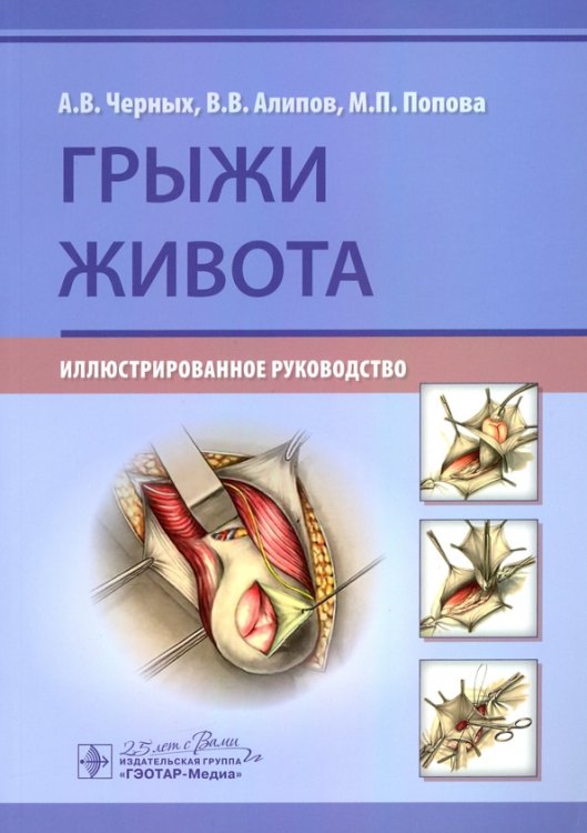 Грыжи живота. Иллюстрированное руководство Грыжи живота. Иллюстрированное руководство