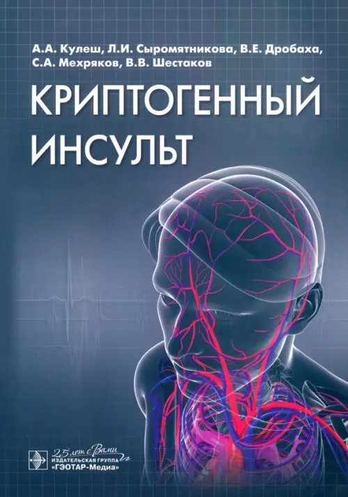 Криптогенный инсульт. Рукводство