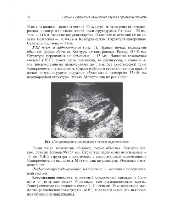 Редкие и интересные клинические случаи в практике интерниста