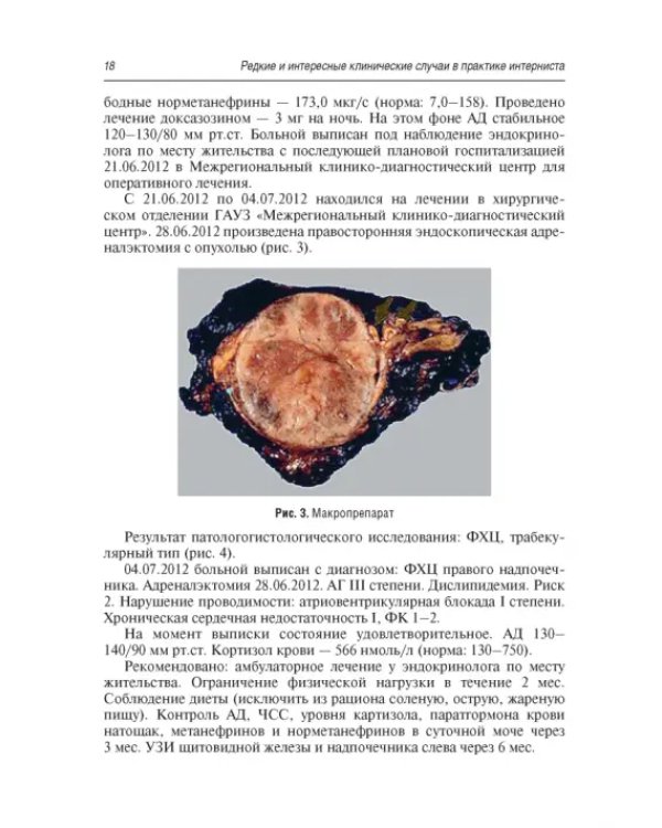 Редкие и интересные клинические случаи в практике интерниста
