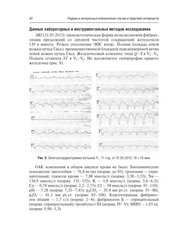 Редкие и интересные клинические случаи в практике интерниста