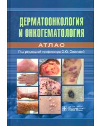 Дерматоонкология и онкогематология. Атлас
