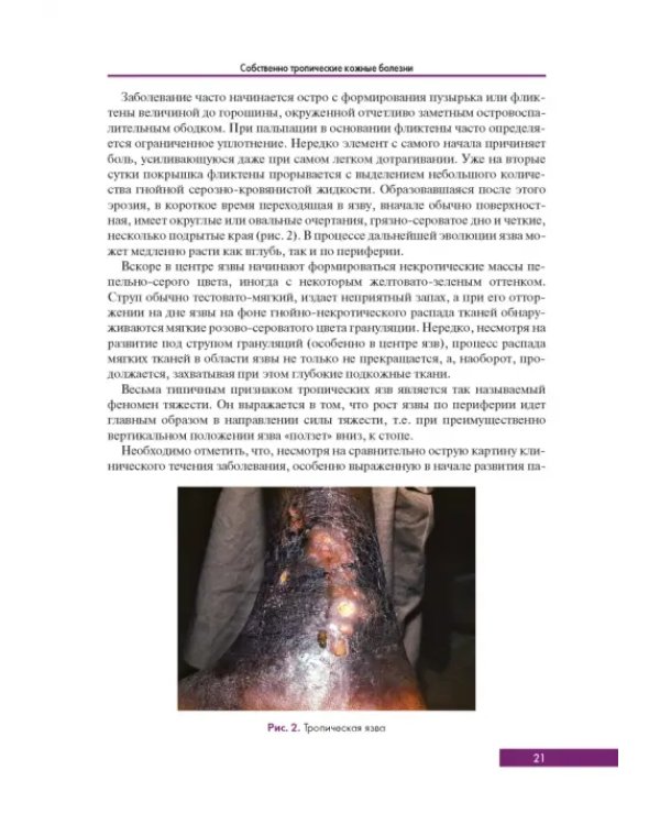Тропическая дерматология. Руководство
