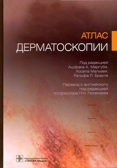 Атлас дерматоскопии Атлас дерматоскопии
