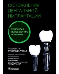 Осложнение дентальной имплантации. Этиология, профилактика и лечение