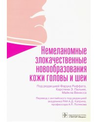 Немеланомные злокачественные новообразования кожи головы и шеи