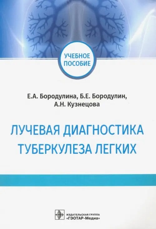 Лучевая диагностика туберкулеза легких. Учебное пособие Лучевая диагностика туберкулеза легких. Учебное пособие