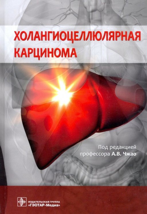 Обложка книги «Холангиоцеллюлярная карцинома» — Чжао Алексей Владимирович, Бугаев С. А., Варава А. Б., ISBN 9785970459553