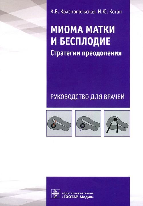 Миома матки и бесплодие. Стратегии преодоления