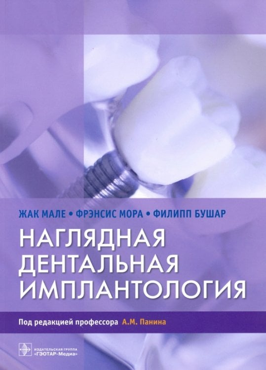Обложка книги «Наглядная дентальная имплантология» — Мале Жак, Мора Фрэнсис, Бушар Филипп, ISBN 9785970459034