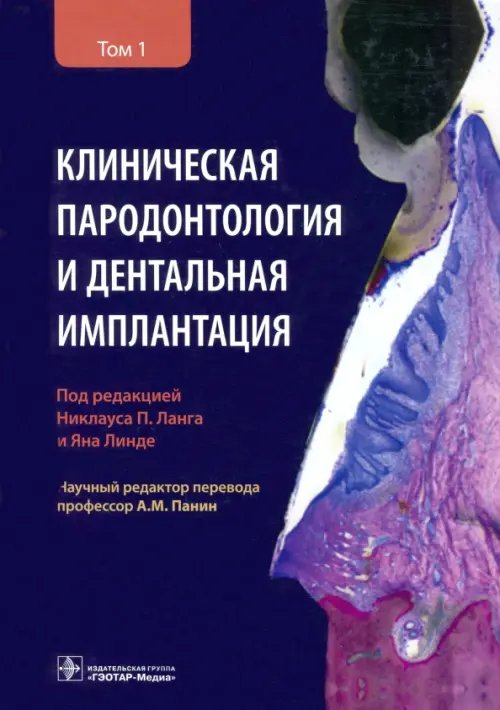 Клиническая пародонтология и дентальная имплантация. В 2-х томах. Том 1 Клиническая пародонтология и дентальная имплантация. В 2-х томах. Том 1