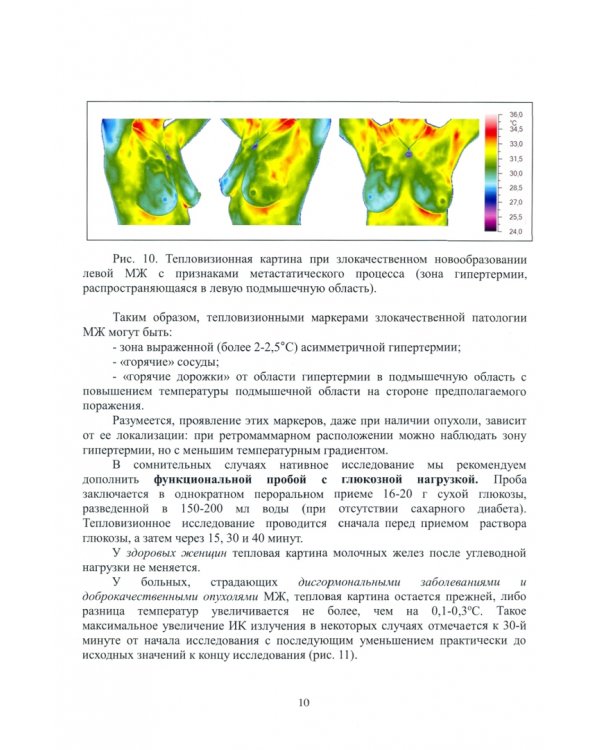 Тепловизионная скрининг-диагностика. Болезни молочной железы. Атлас термограмм