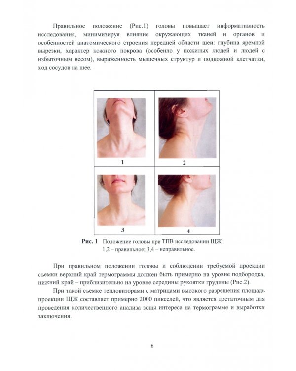 Тепловизионная скрининг-диагностика. Болезни щитовидной железы. Атлас термограмм