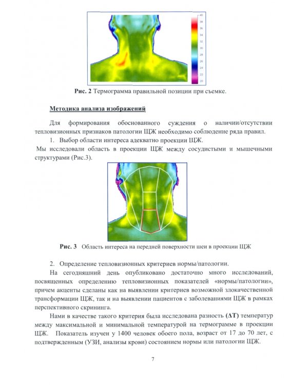 Тепловизионная скрининг-диагностика. Болезни щитовидной железы. Атлас термограмм
